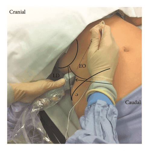 QL блокада - 4.png